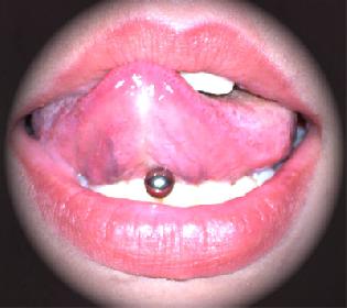 la bouche