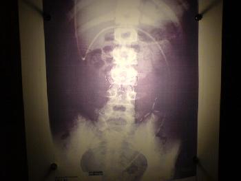 diePicknickerin: schmetterlinge im bauch?