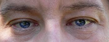 Augen
