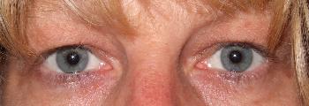 meine Augen