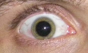 Meine grnen Augen