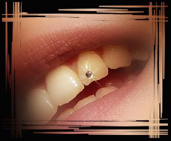 Mein Zahnschmuck ...